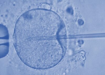 Application des technologies en embryologies chez les animaux pré-pubères et pubères pour l&rsquo;accélération de la sélection génétique et le développement du secteur ovin (2021)